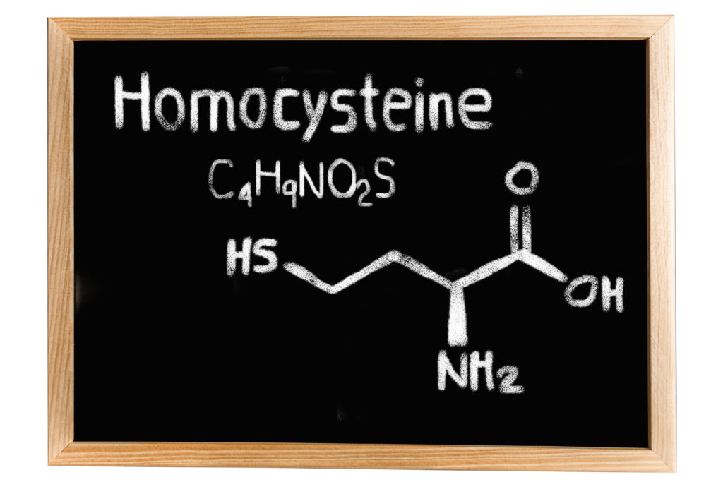 high homocysteine