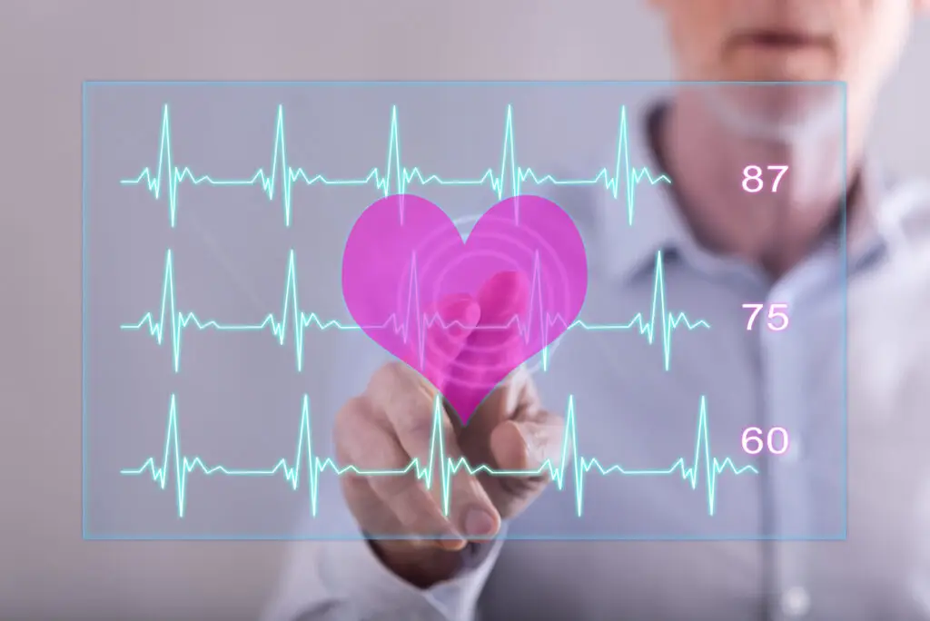 arrhythmia chart