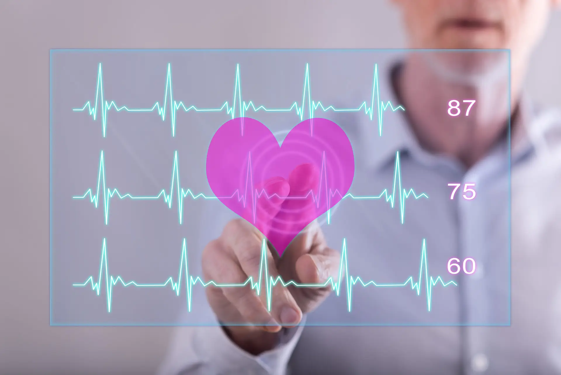 arrhythmia chart