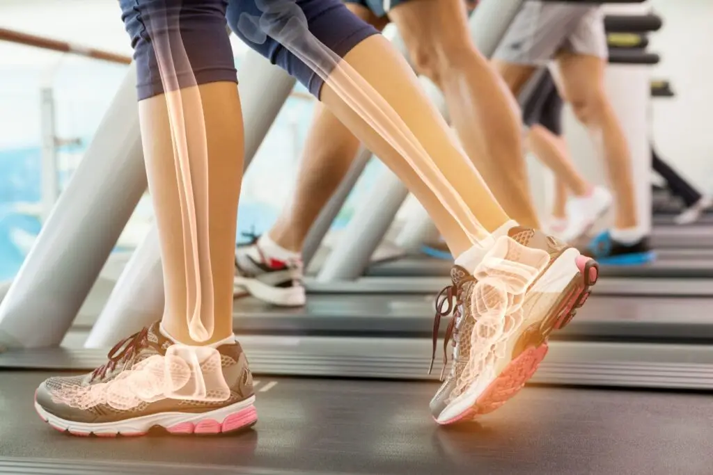 vitamin d & bone health showing a picture of a leg