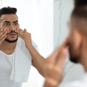 Dull Skin Concept. Worried Arab Guy Looking At Mirror And Touching Face