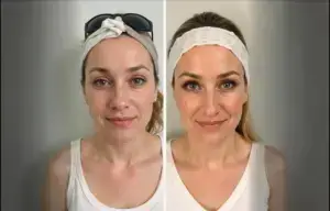 Benefits of HydraFacial