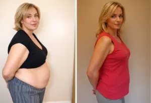 b12 shots for weight loss 