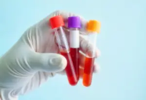 menopause test 